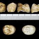 Múltiples vistas de un molar perteneciente al cráneo